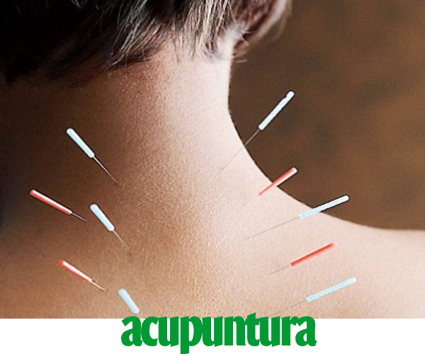 acupuntura