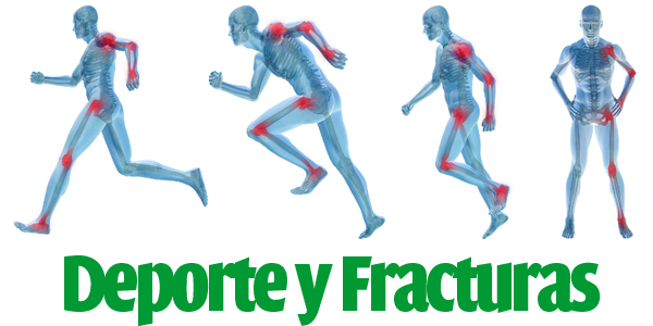 deporte-y-fracturas